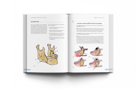 Orthognathic Surgery. Techniques, tips & tricks.