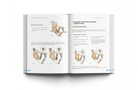 Orthognathic Surgery. Techniques, tips & tricks.