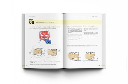Orthognathic Surgery. Techniques, tips & tricks.
