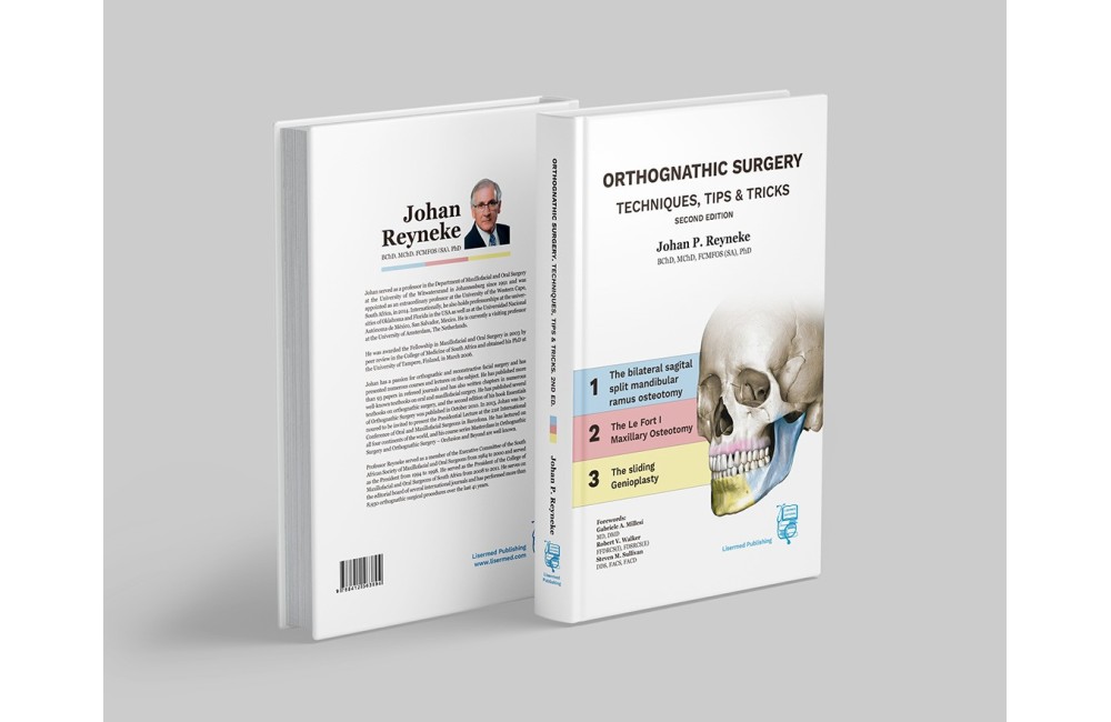 Orthognathic Surgery. Techniques, tips & tricks.