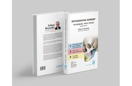 Orthognathic Surgery. Techniques, tips & tricks.