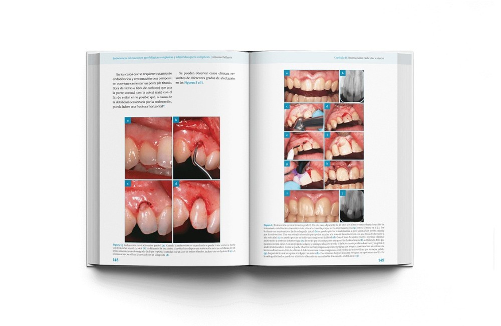 ENDODONCIA. Alteraciones morfológicas...