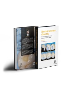 Restauraciones directas. Procedimientos clínicos en los protocolos de trabajo - Marius Bud - Lisermed 2