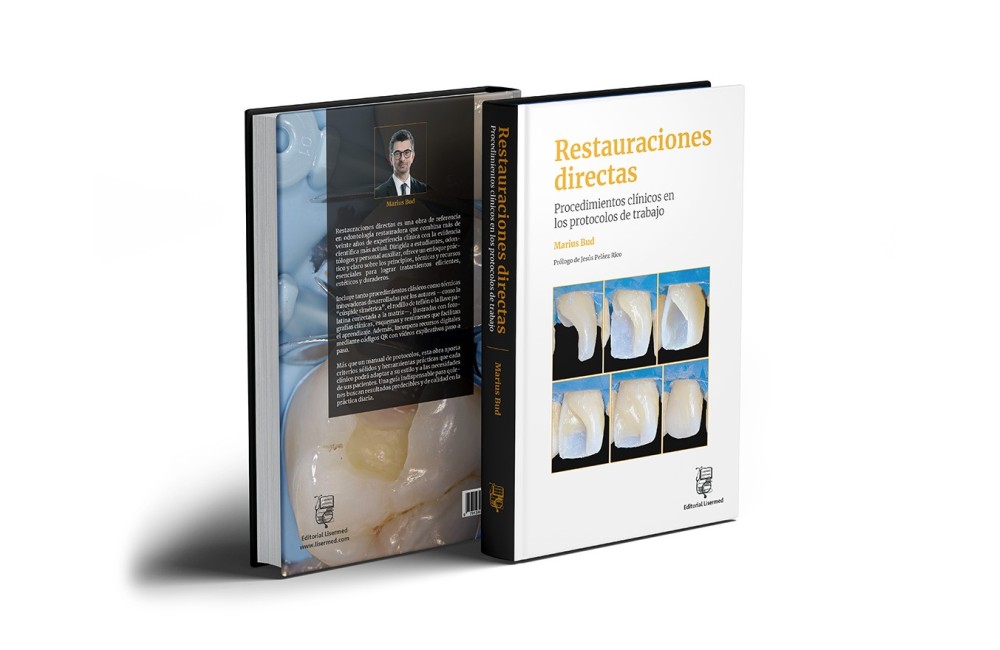 Restauraciones directas. Procedimientos...