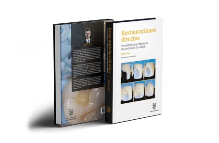 Restauraciones directas. Procedimientos clínicos en los protocolos de trabajo