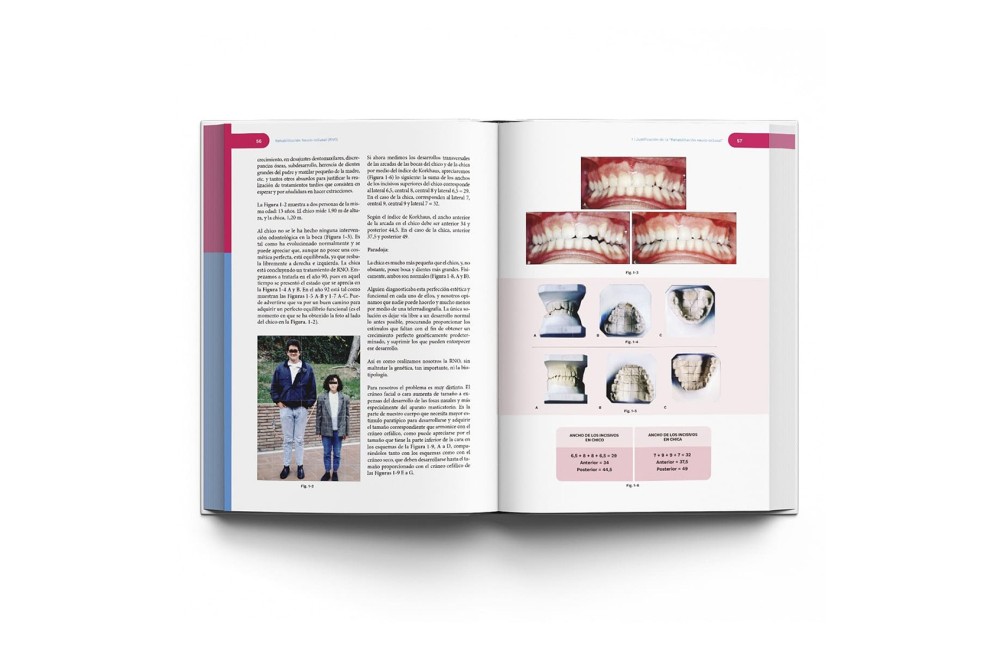 Rehabilitación Neuro-Oclusal (RNO)