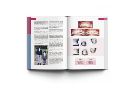 Rehabilitación Neuro-Oclusal (RNO)