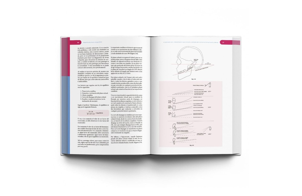 Rehabilitación Neuro-Oclusal (RNO)