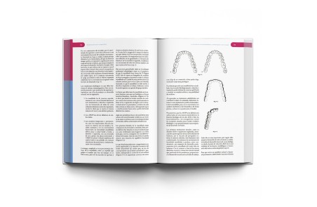 Rehabilitación Neuro-Oclusal (RNO)