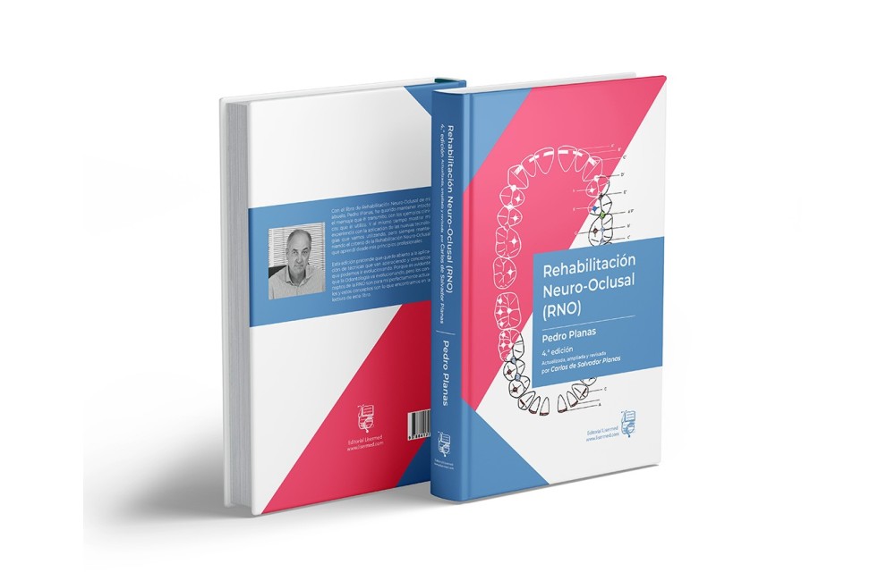 Rehabilitación Neuro-Oclusal (RNO)