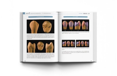 La Guía Definitiva para la Morfología Dental. Morfología de los Dientes Naturales 2 (Avanzado)