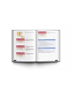 Principios de Cirugía de Tejidos Blandos. Guía Completa de Procedimientos Paso a Paso. Lee H. Silverstein - Lisermed 2