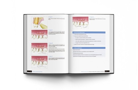 Principios de Cirugía de Tejidos Blandos. Guía Completa de Procedimientos Paso a Paso