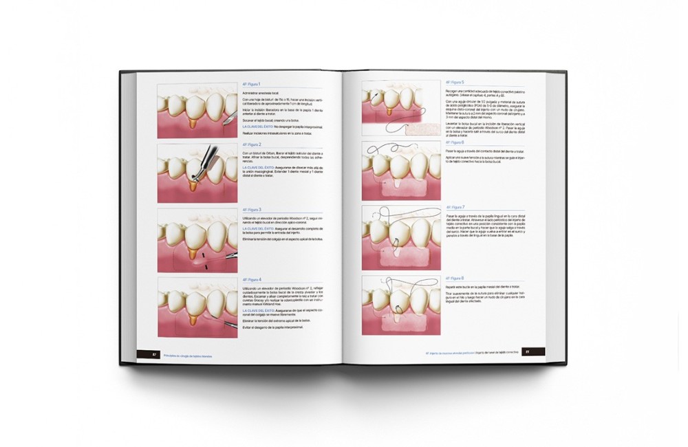 Principios de Cirugía de Tejidos Blandos. Guía...