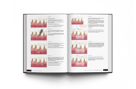 Principios de Cirugía de Tejidos Blandos. Guía Completa de Procedimientos Paso a Paso