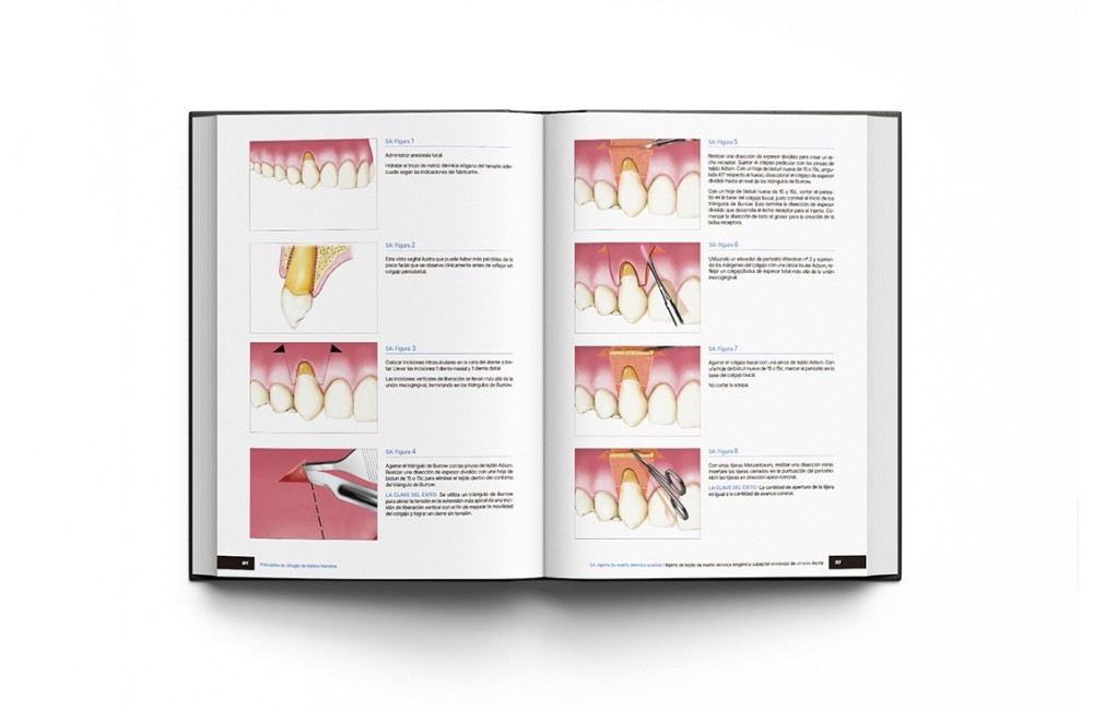Principios de Cirugía de Tejidos Blandos. Guía...