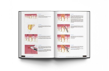 Principios de Cirugía de Tejidos Blandos. Guía Completa de Procedimientos Paso a Paso