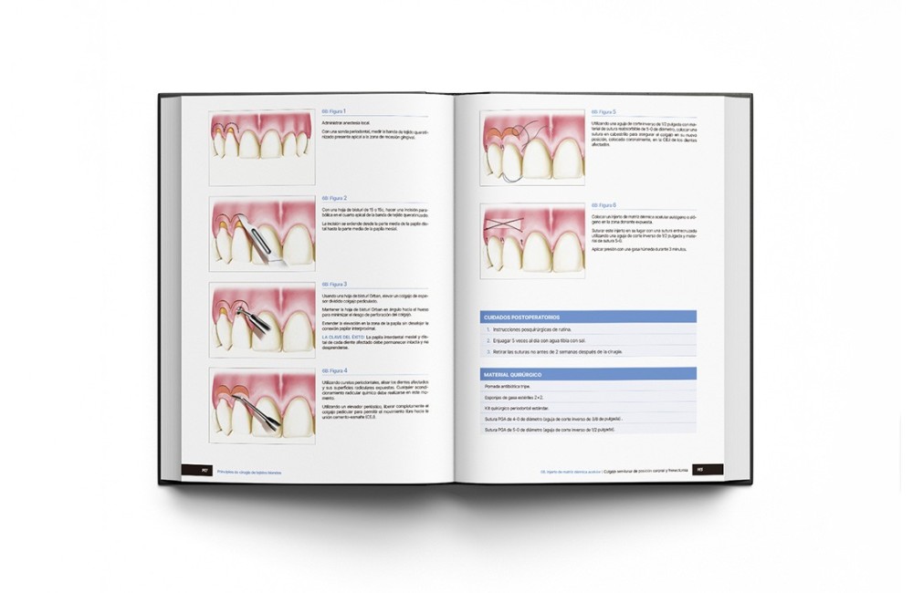 Principios de Cirugía de Tejidos Blandos. Guía...