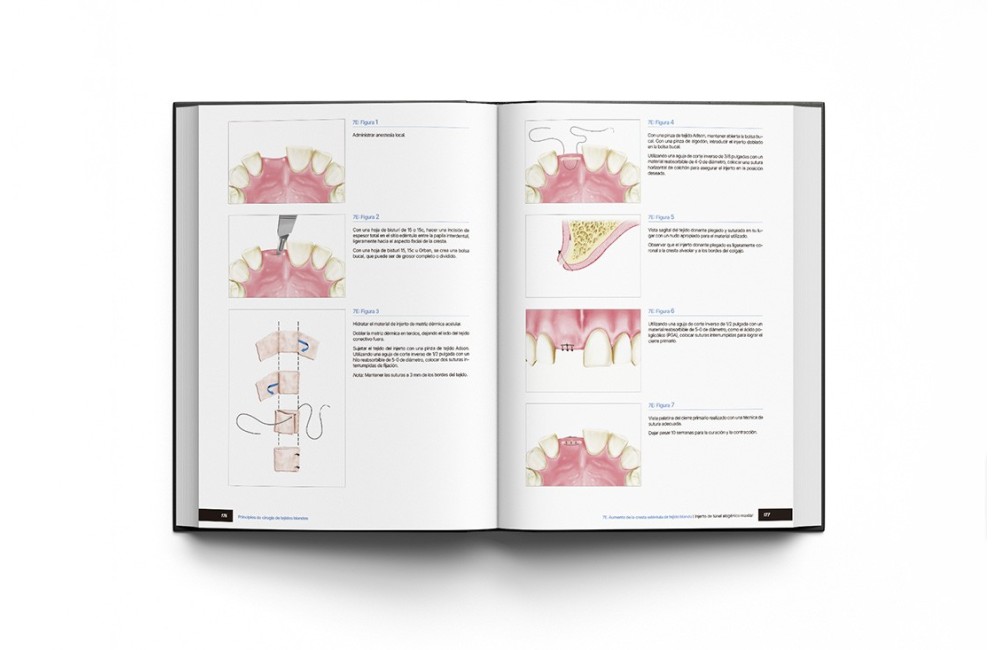 Principios de Cirugía de Tejidos Blandos. Guía...