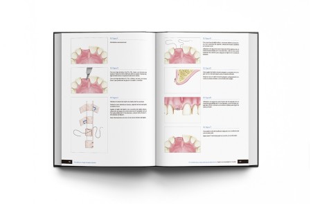 Principios de Cirugía de Tejidos Blandos. Guía Completa de Procedimientos Paso a Paso