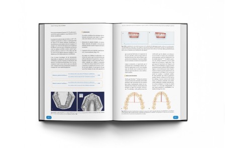 Rehabilitación Oral Estética con Carillas: Guía de Preparación del Tratamiento y Conceptos Clínicos