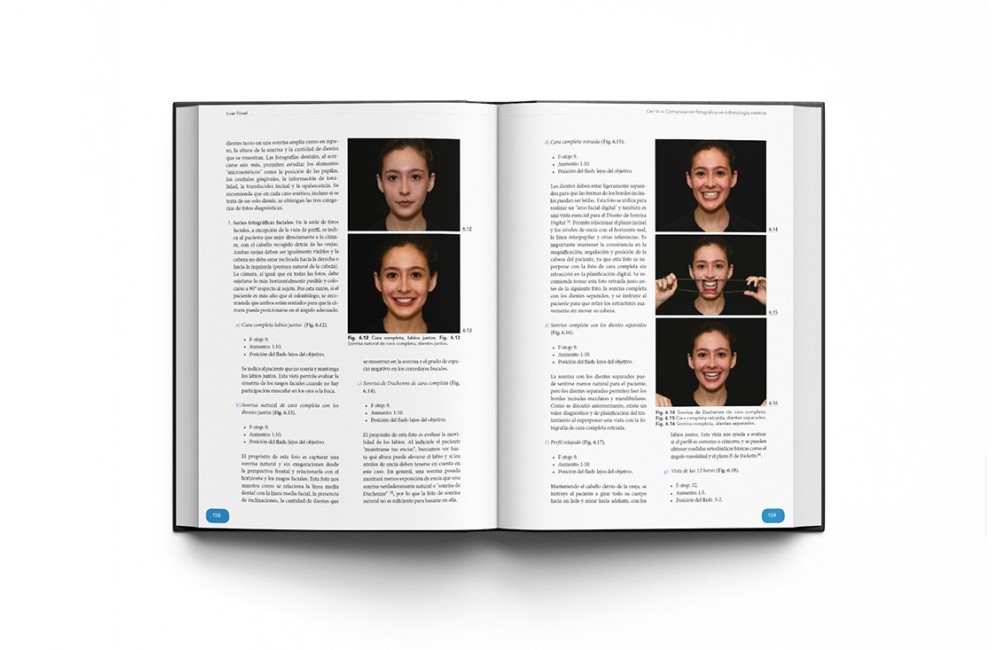 Rehabilitación Oral Estética con Carillas: Guía...