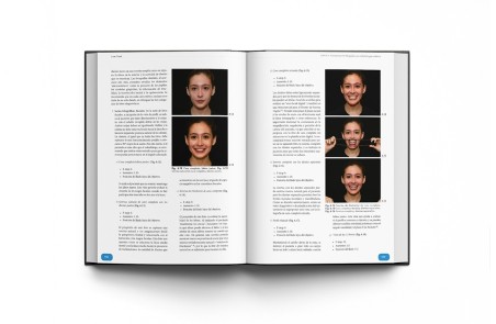 Rehabilitación Oral Estética con Carillas: Guía de Preparación del Tratamiento y Conceptos Clínicos