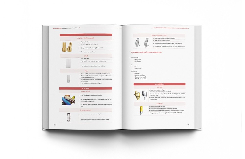 Implantoprótesis. Guía de Prótesis Dental Sobre...