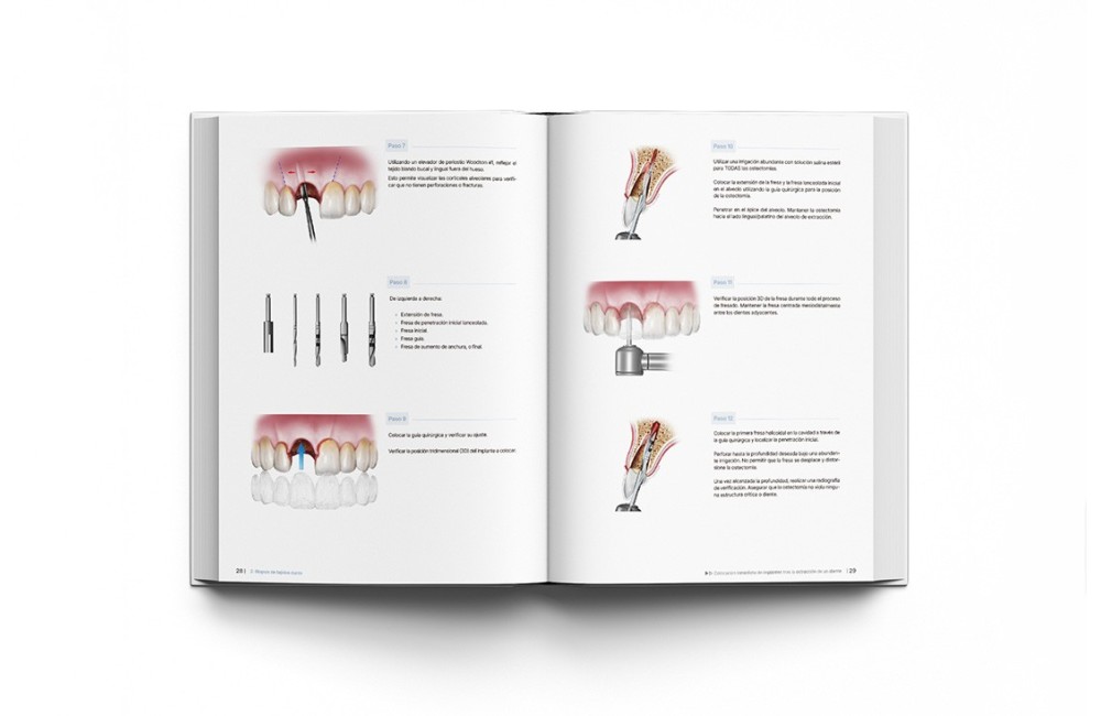 Principios de Regeneración de Tejidos Duros y...