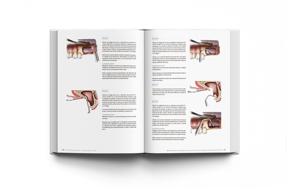 Principios de Regeneración de Tejidos Duros y...