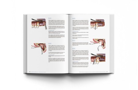 Principios de Regeneración de Tejidos Duros y Terapia de Implantes