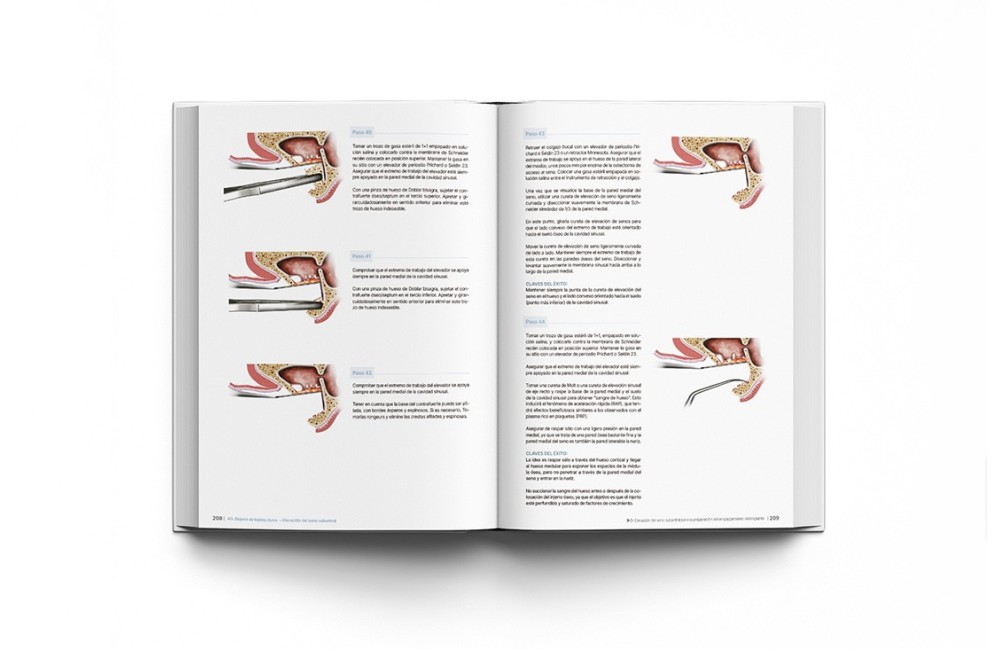 Principios de Regeneración de Tejidos Duros y...