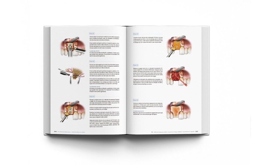 Principios de Regeneración de Tejidos Duros y...