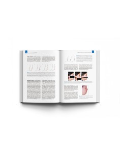 Arte y Ciencia de la Genioplastia Deslizante. Johan P. Reyneke - Lisermed 2