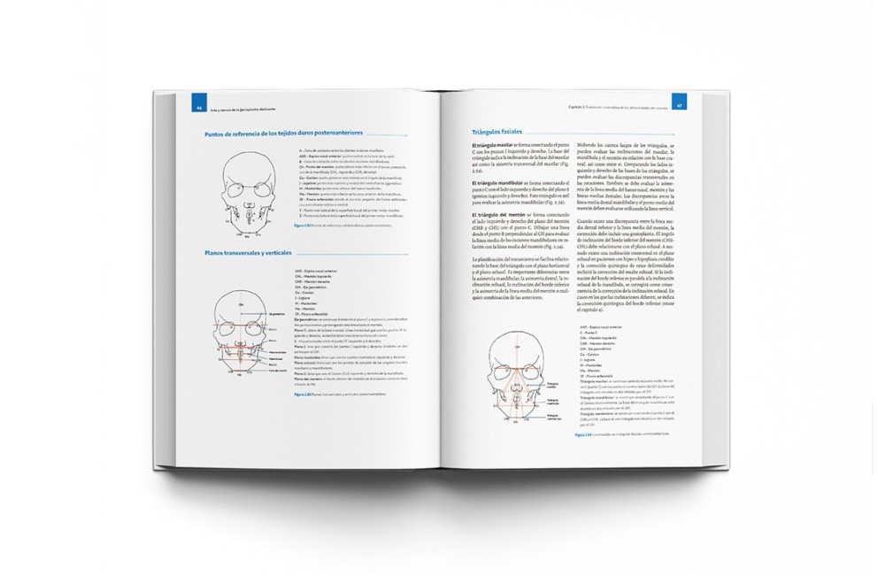 Arte y Ciencia de la Genioplastia Deslizante