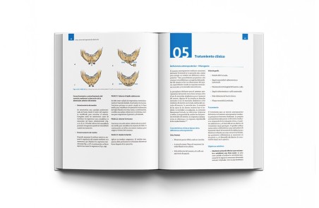 Arte y Ciencia de la Genioplastia Deslizante