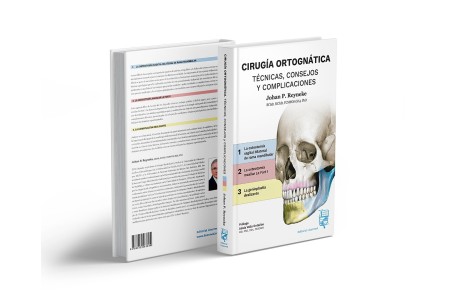 Cirugía Ortognática - Técnicas, Consejos y Complicaciones