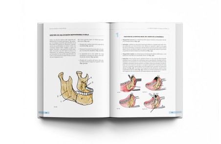 Cirugía Ortognática - Técnicas, Consejos y Complicaciones