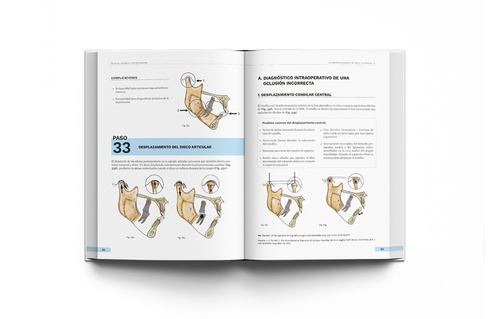 Cirugía Ortognática - Técnicas, Consejos y...