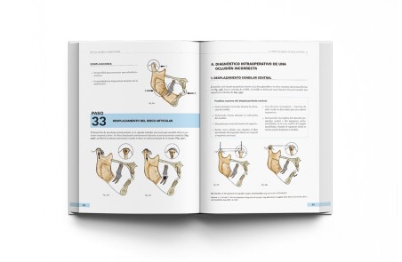 Cirugía Ortognática - Técnicas, Consejos y Complicaciones