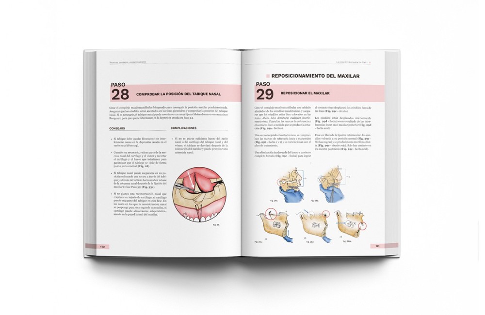 Cirugía Ortognática - Técnicas, Consejos y...