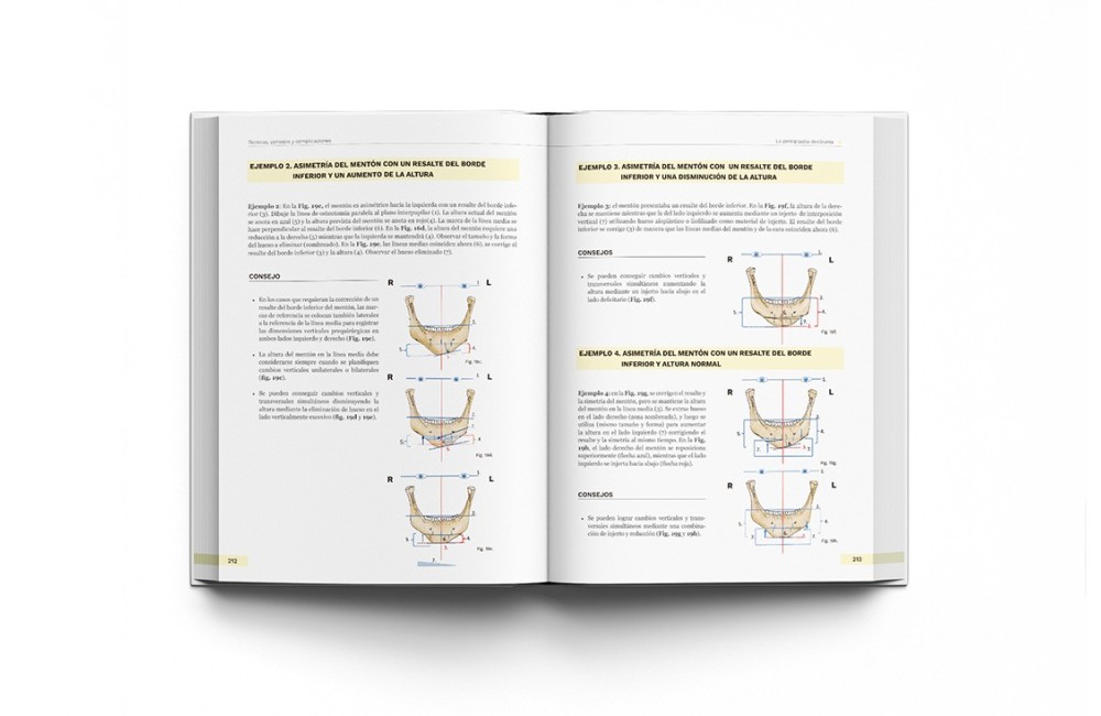 Cirugía Ortognática - Técnicas, Consejos y...