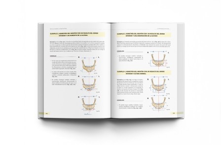 Cirugía Ortognática - Técnicas, Consejos y Complicaciones