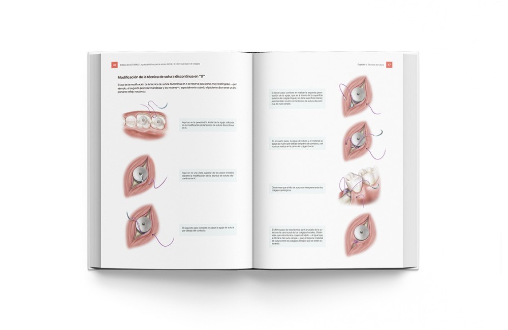 El Libro de Suturas. Guía Sutura Dental y...