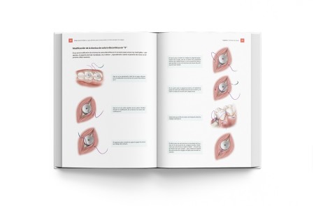 El Libro de Suturas. Guía Sutura Dental y Cierre Quirúrgico Colgajos