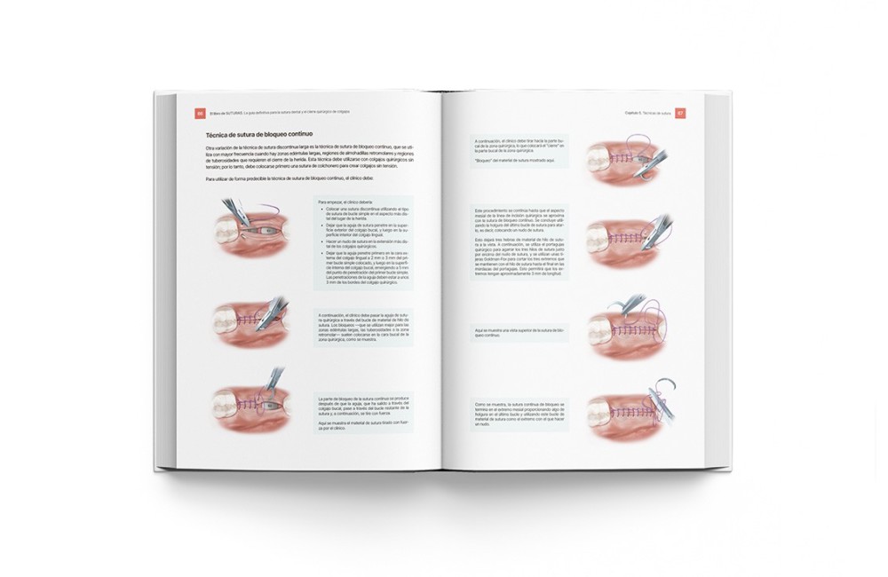 El Libro de Suturas. Guía Sutura Dental y...