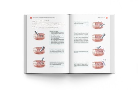 El Libro de Suturas. Guía Sutura Dental y Cierre Quirúrgico Colgajos