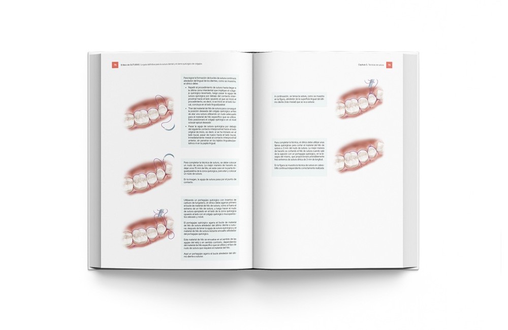 El Libro de Suturas. Guía Sutura Dental y...