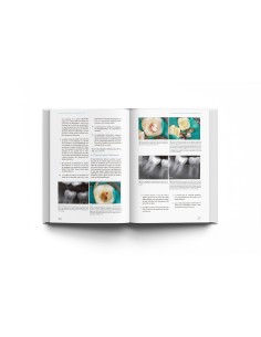 Materiales Biocerámicos en Endodoncia Clínica - Drukteinis / Camilleri - LISERMED 2