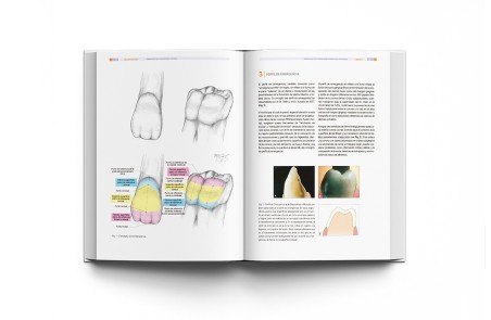 Implantología Dental de un Vistazo